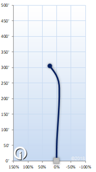 Kastaplast Kaxe Z K1 Glow