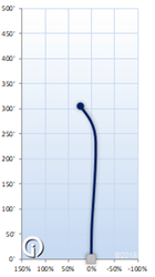 Kastaplast Kaxe Z K1 Glow