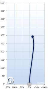 Kastaplast Svea K1 Glow